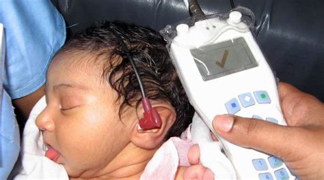 OAE (Otoacoustic Emissions) Hearing Test .